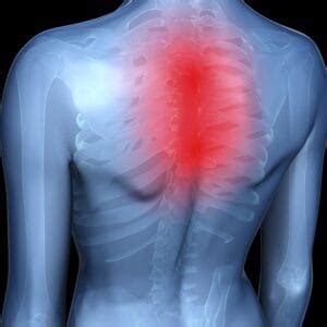 6 Most Common Causes of Middle Back Pain