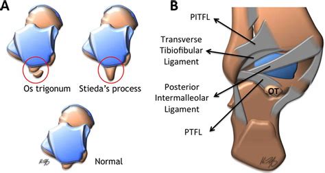 Ankle impingement syndrome causes, symptoms, diagnosis & treatment