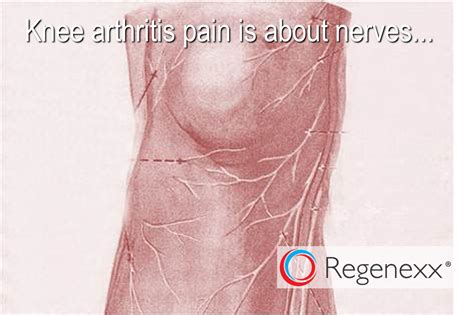 Nerves In the Knee Joint: More Evidence that the Pain of Arthritis is ...