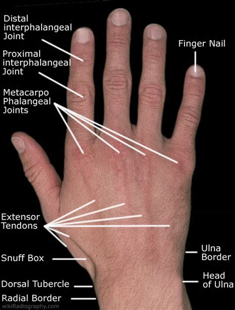 Hand/Wrist - wikiRadiography