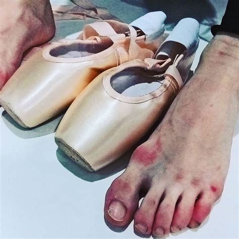 What Do Professional Ballerinas Feet Look Like - img-Aaralyn