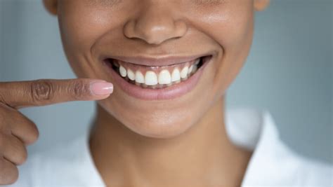 Why Are My Gums Black? 5 Crucial Things to Know