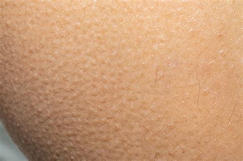 Macro Of Womans Skin With Goosebumps Stock Photo - Download Image Now - Cold Temperature, Goose ...