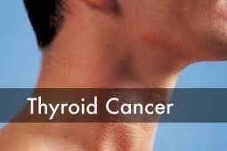 Thyroid Cancer- Signs, Symptoms & Management