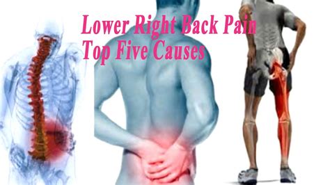 Lower Right Back Pain – Top Five Causes of Lower Back Pain Right Side - YouTube