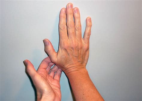 Stretching the Transverse Carpal Ligament?