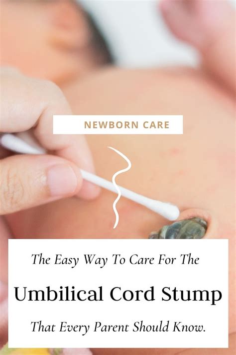 Baby's Umbilical Cord Stump: How To Care For It (It's Easy!) | Newborn care, Baby care tips ...