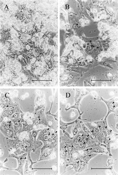 Cytopathic effect of human cytomegalovirus (HCMV) in cultured human ...