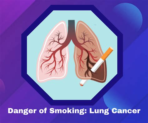 The danger of Smoking: Lung Cancer | Prolife Cancer Centre