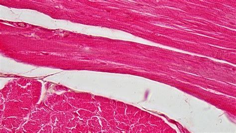 Muscle Tissue: Cross Section Whole Skeletal Muscle | Flickr