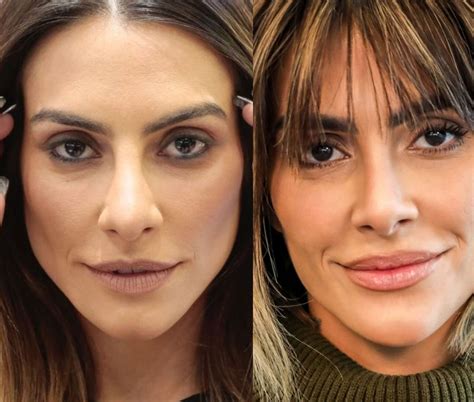 Confira o antes e depois de 10 famosas que fizeram rinoplastia - PaiPee