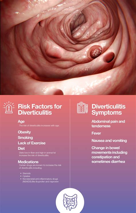 How Long Can You Live After Diverticulitis Surgery - Printable Templates Free