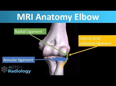 MRI Anatomy of Lateral Elbow Ligaments - YouTube