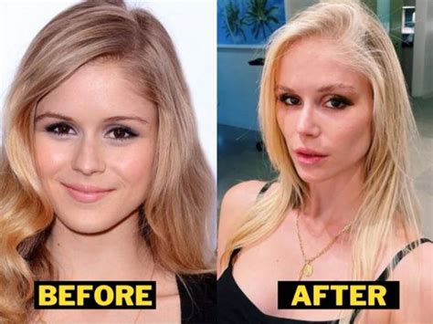 Erin Moriarty Before And After Pictures: Did Erin Moriarty Has Undergone Plastic Surgery?