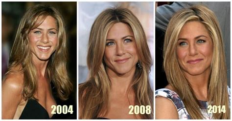 Jennifer Aniston Plastic Surgery: Before & After Photos | PlasticSurgeryInsights.com