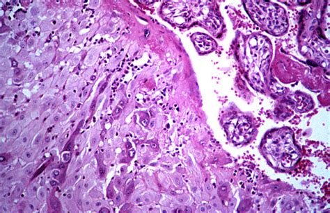 HLS [ Female Reproductive System, placenta, decidual cells] HIGH MAG