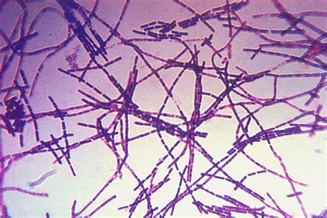 File:Bacillus anthracis Gram.jpg - Wikipedia