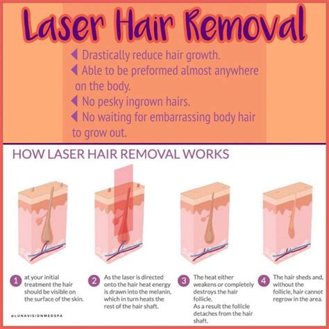 Laser Hair Removal