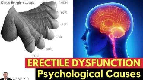 💋Psychological Causes of Erectile Dysfunction – All About Sexual Dysfunction