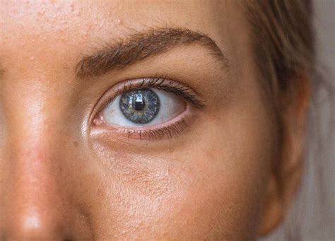 The 3 Best Under-Eye Filler Alternatives | RealSelf News