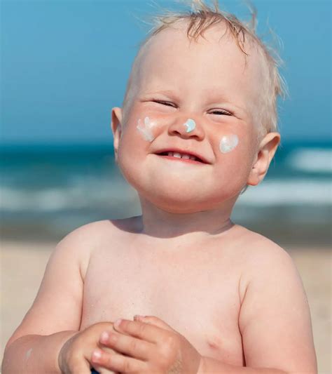 Sunburn In Babies: Causes, Treatment And Prevention | MomJunction