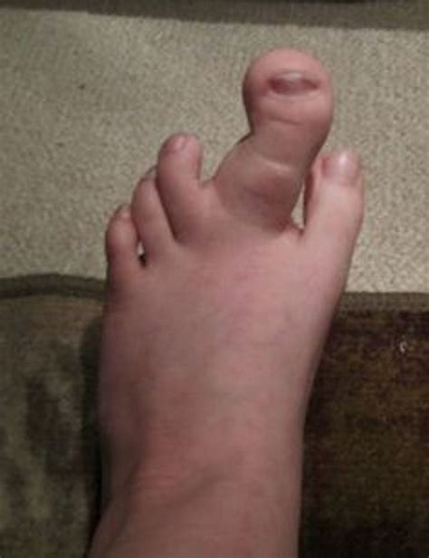 Pin by Susan Cotterman Schildt on Wierd | Funny pictures fails, Toe pics, Foot pics