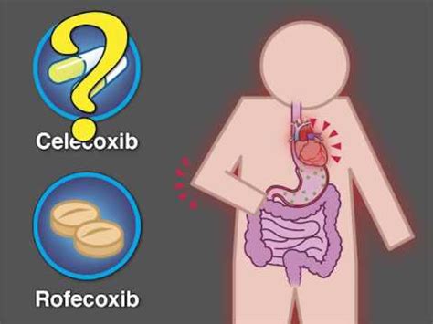 Cardiovascular Safety of Celecoxib | NEJM - YouTube