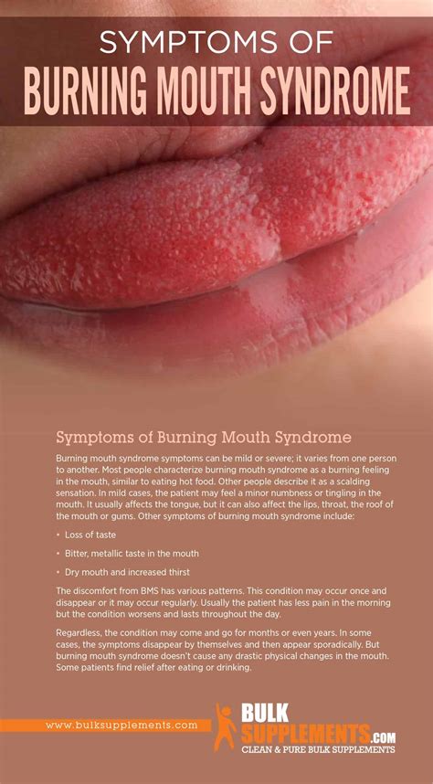 Tablo | Read 'Burning Mouth Syndrome (BMS): Symptoms, Causes & Treatment' by