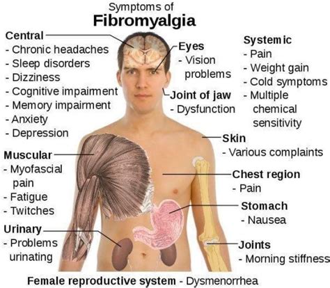 Symptoms of Fibro | Fibromyalgia causes, Fibromyalgia symptoms, Fibromyalgia cure