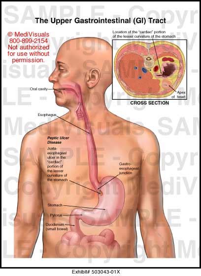 Medivisuals The Upper Gastrointestinal (GI) Tract Medical Illustration