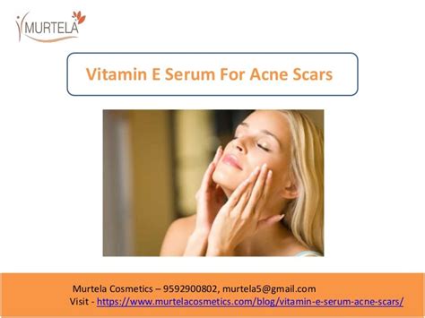 Vitamin E serums for acne scars