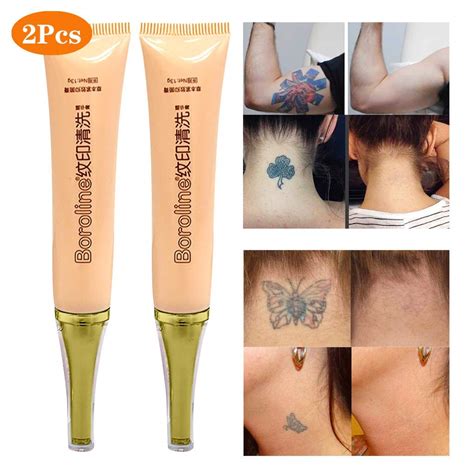 Tattoo Removal Cream - TATTOOS