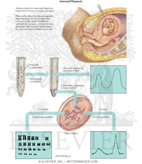 Birth Defects: Antenatal Diagnosis