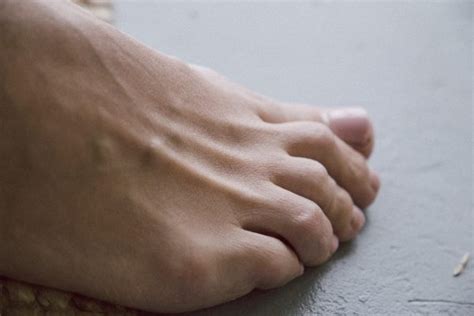 7 Signs of Arthritis in Your Feet - Foot and Ankle Group