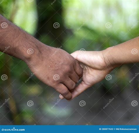 Two Friends are Hand-shaking, One with White Hands and the Other with Black Hands Stock Photo ...