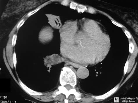 Learning Radiology - Archives 2017