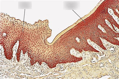 Photomicrograph of Mucogingival Junction Diagram | Quizlet