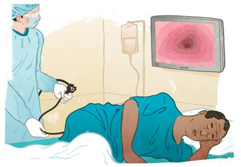 COLONOSCOPY – WHAT IT’S LIKE BEFORE, DURING AND AFTER COLONOSCOPY