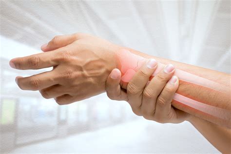 Wrist Fracture Treatment | Ladan Hajipour Orthopaedic Surgeon