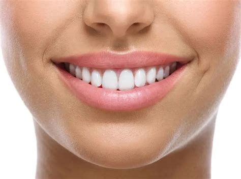 TruSmile Veneers Review: Are They Worth the Price? - Dentaly.org