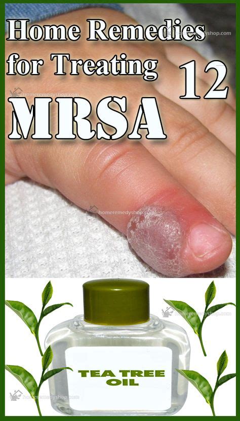 12 Home Remedies for Treating MRSA | Home health remedies, Remedies, Home remedies