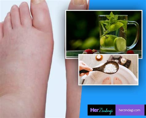 Have Swollen Feet? These Home Remedies Will Help You Out | HerZindagi