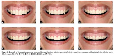 Different Tooth Shapes - Dental News Network