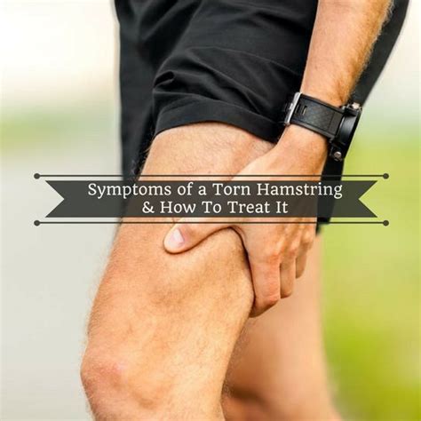 Symptoms of a Torn Hamstring & How to Treat It | Torn hamstring ...