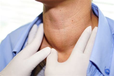 Single Radiofrequency Ablation Has Long-Term Effects on Benign Thyroid Nodules - Endocrinology ...