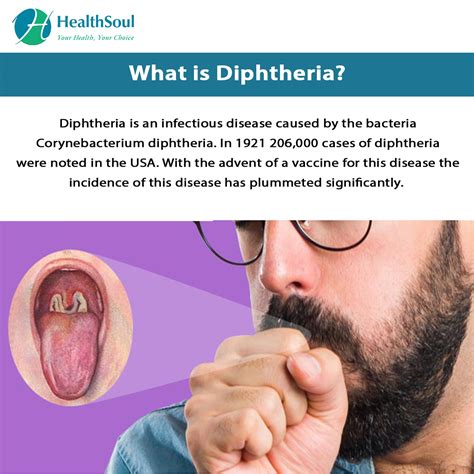 Diphtheria: Symptoms and Treatment | Internal Medicine | HealthSoul