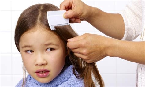 'Frust' Nak Hilangkan Kutu Rambut Pada Anak? Ini 7 Cara Berkesan