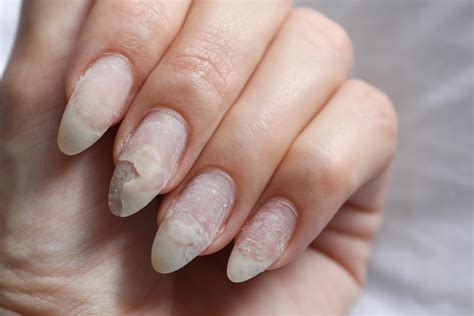 Do Acrylics Damage Nails