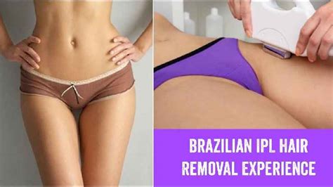 What does full body laser hair removal include?