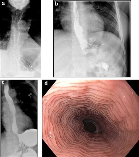 Examples of feline esophagus. a Front double contrast view; b, c... | Download Scientific Diagram